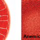 Image for article titled Watching Blood Dry Is Surprisingly Interesting